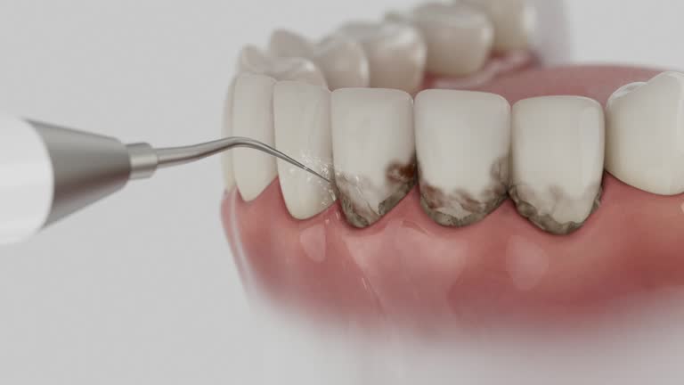 Reliable Wisdom Tooth Removal contractor in Newaygo County County, MI by Dentist Open Now
